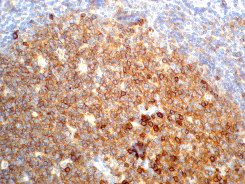 CD38 Enzyme