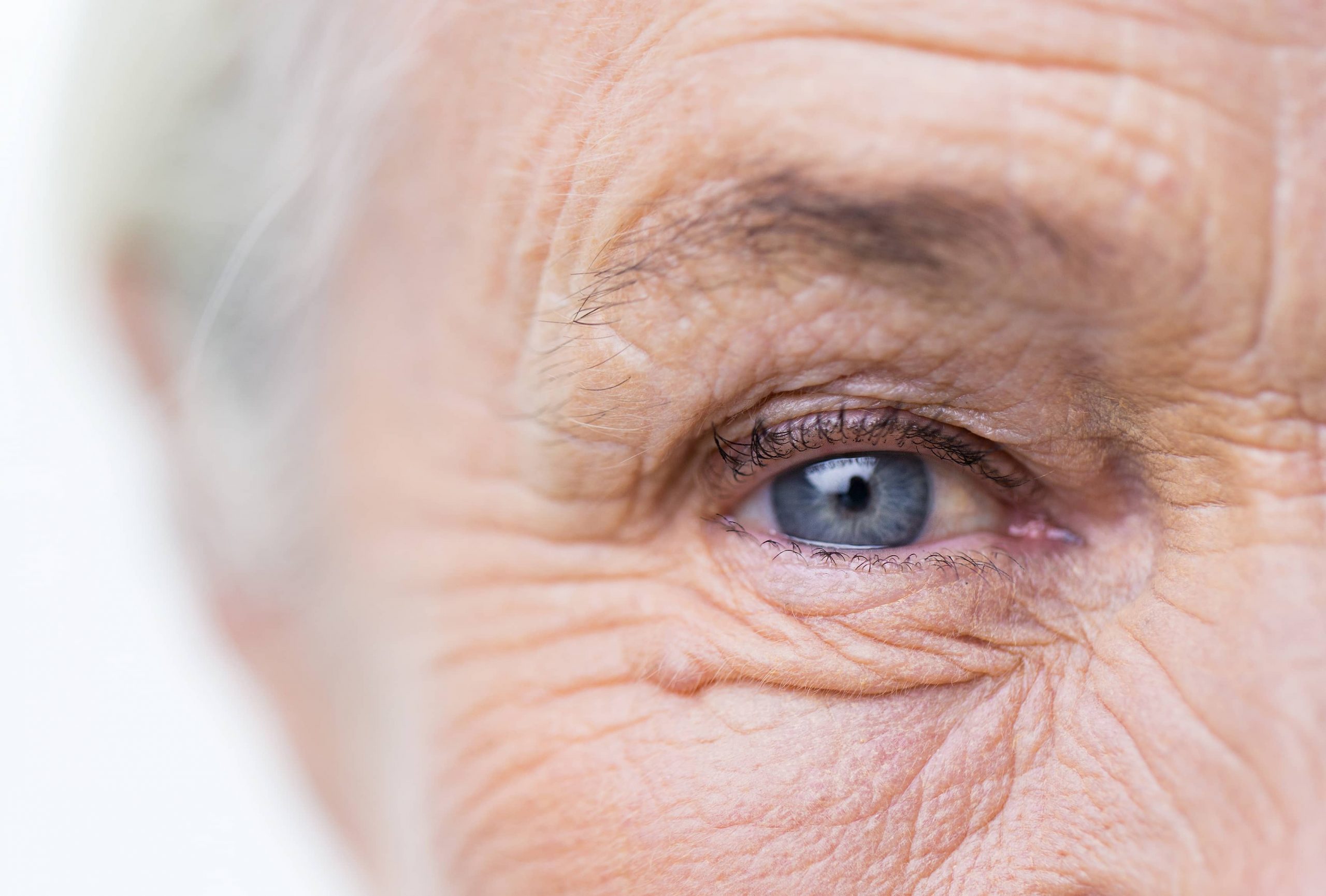 eye of senior citizen
