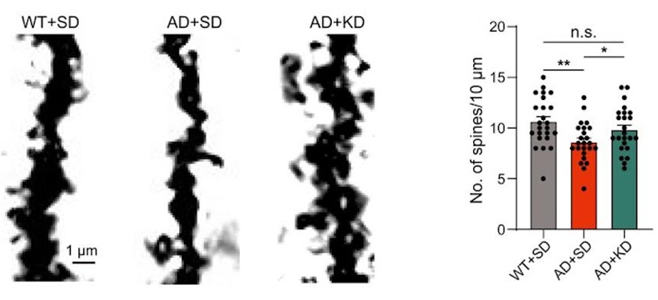 keto diet restores neuron degeneration