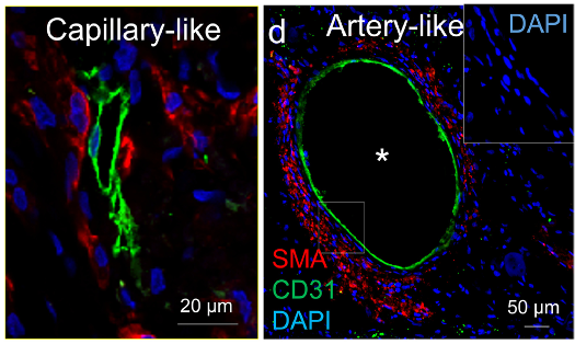 capillaries and arteries