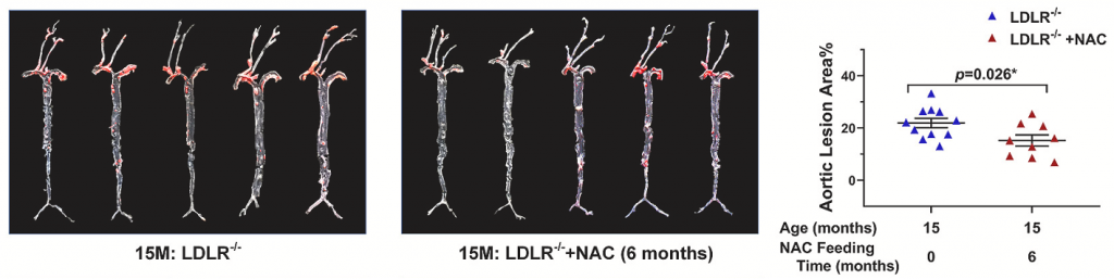 NAC reduces blood vessel lesions