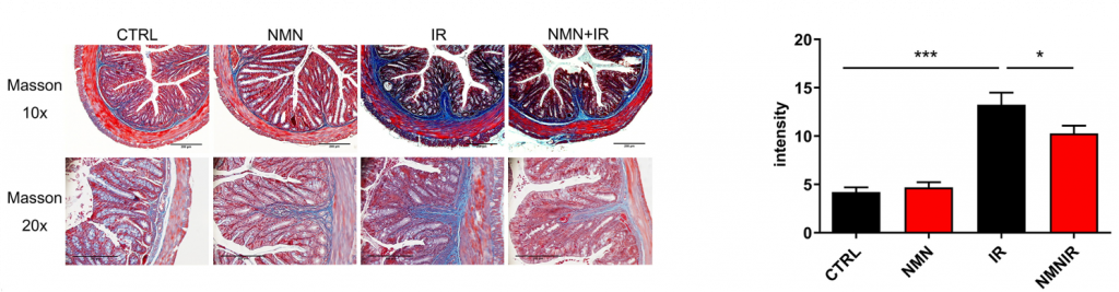 NMN reduces radiation-induced intestinal damage