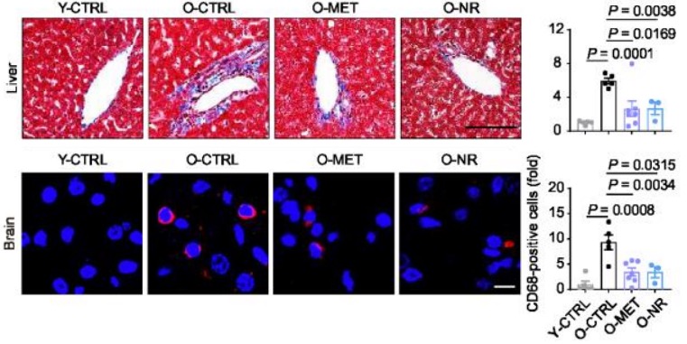 effects of metformin and nicotinamide riboside (nr)