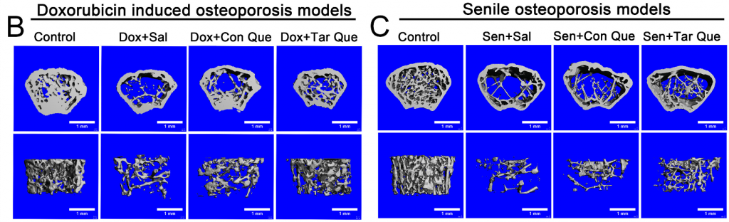 Quercetin increases bone formation in mice with osteoporosis