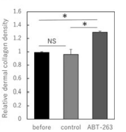 Navitoclax increases density of collagen in aged skin