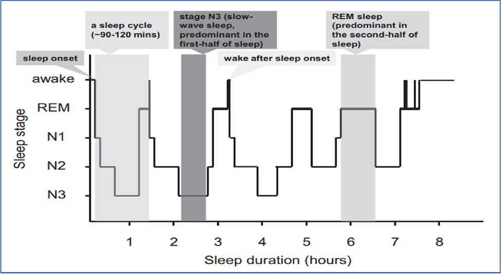  Illustration of Sleep Stages. The diagram depicts the progression of sleep stages starting from wakefulness and transitioning through Stage 1 NREM sleep (N1), Stage 2 NREM sleep (N2), and reaching the deep, restorative Stage 3 NREM sleep (N3). This is followed by REM sleep, with potential brief awakenings before the cycle recommences.