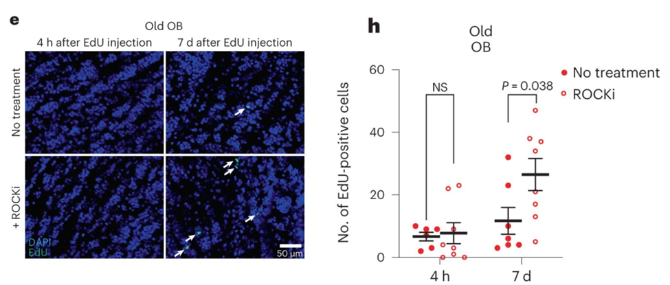 Enhanced In Vivo Neurogenesis in Aged Mice with ROCK Inhibition. (Left) Visual representation of green-stained new neurons (EdU+) originating from activated brain stem cells in the subventricular zone (SVZ) of old mice treated with a ROCK inhibitor (ROCKi). The new neurons migrate to the olfactory bulb. (Right) Plots illustrating the quantified count of these new neurons after four hours (4 h) and seven days (7 d) following ROCKi treatment.