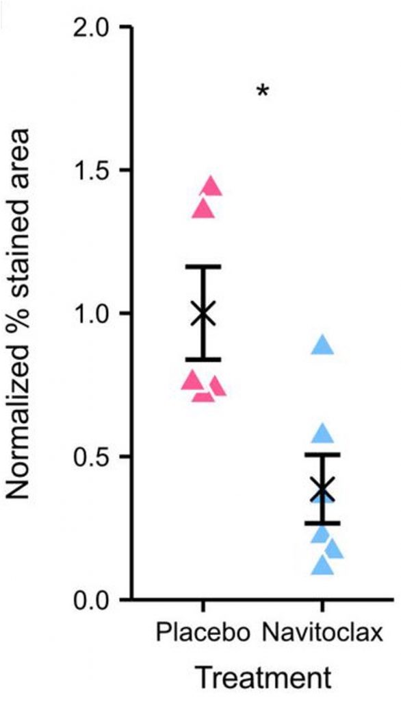 Comparison of liver senescence reduction: Obese mice treated with Senolytic Navitoclax (blue) show a significant decrease in liver senescence (Normalized % stained area) compared to obese mice receiving a placebo (pink).