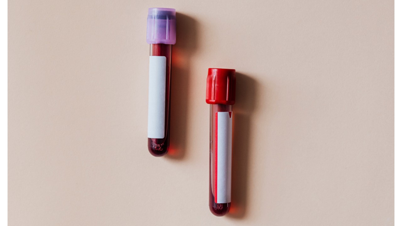 Stanford’s Dr. Andrew Huberman Reveals His Supplement Protocol for