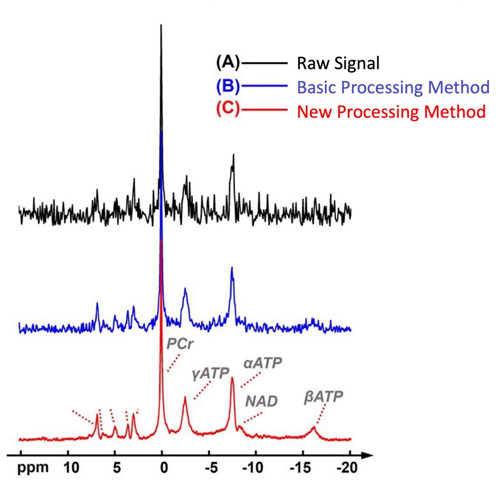 An image of three signals. Signal A and B have too much noise to clearly see the spike for N.A.D., where it is apparent in Signal C 