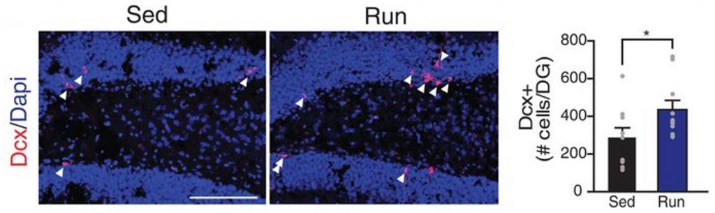 Microscope images showing that there are more cells associated with neurogenesis in mice treated plasma from exercised mice. 