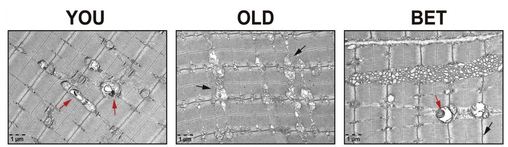 Images from an electron microscope.