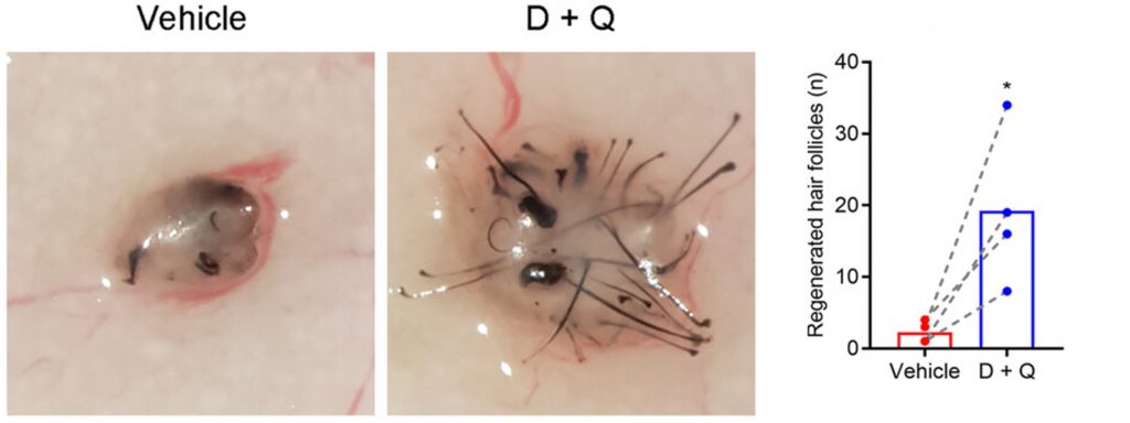 An image of hair follicle and a graph showing the data. 