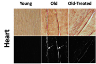 The digestive enzyme trypsin infiltrates the heart in old rats.