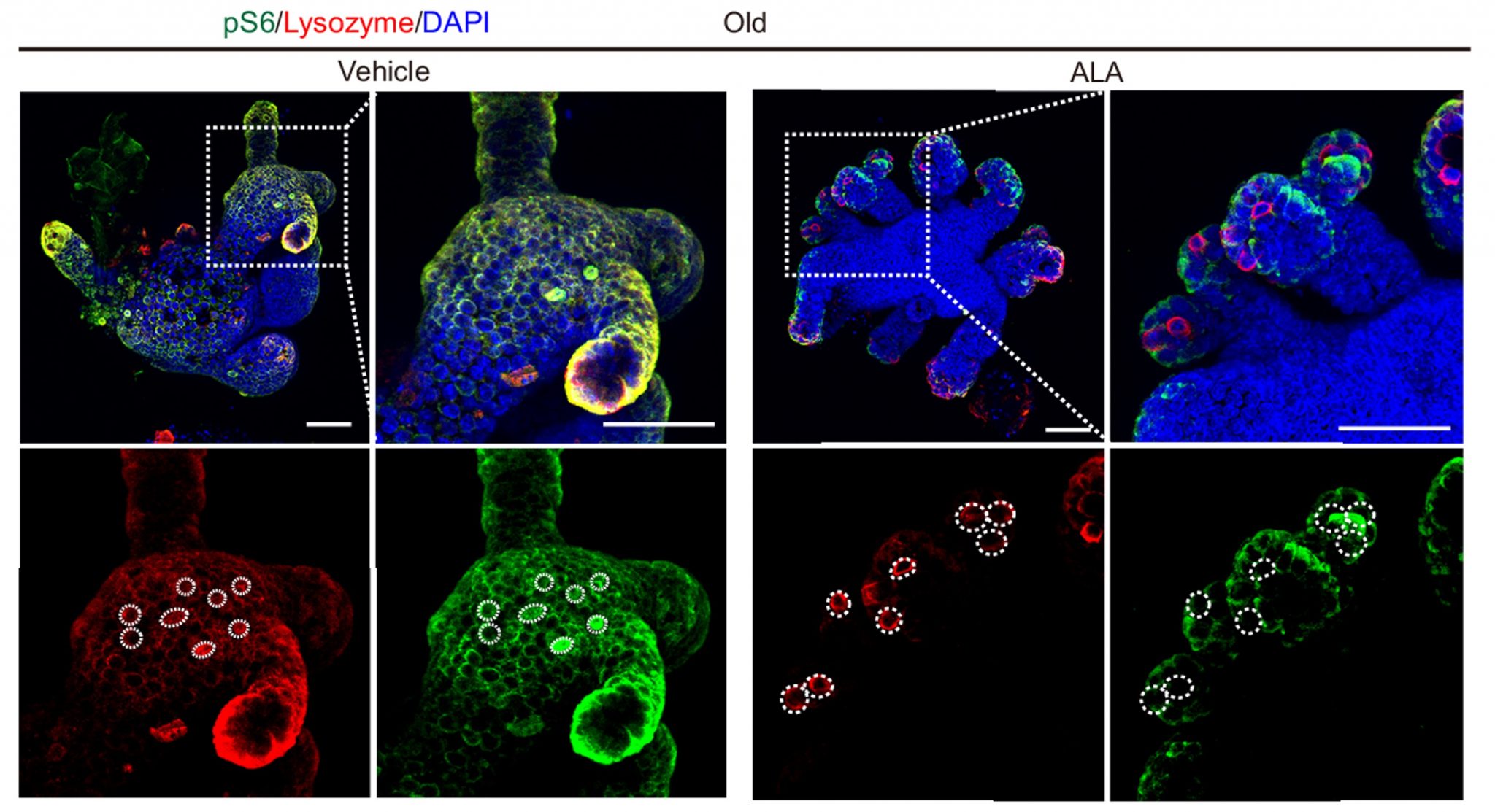 Alpha Lipoic Acid Rejuvenates Stem Cells Improves Gut New Study Shows alpha-lipoic-acid-rejuvenates-stem-cells-improves-gut-new-study-shows