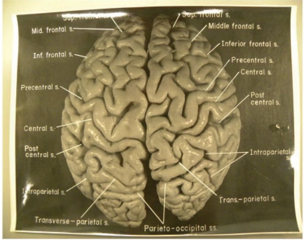 A black and white photograph of a brain. 