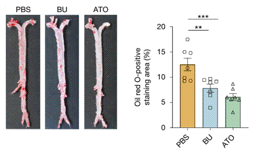 B. uniformis significantly reduced arterial plaque burden.