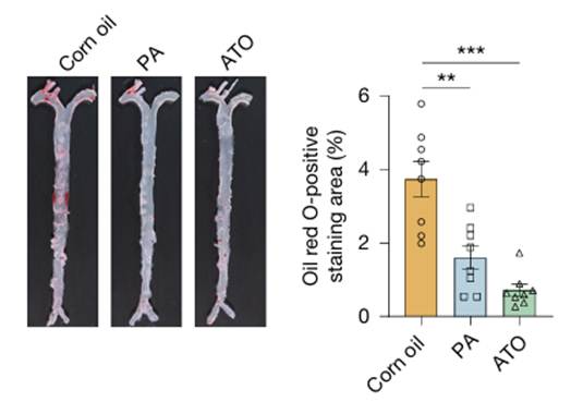 Pentadecanoic acid lowered arterial plaque burden by about 50%.